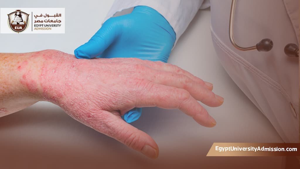 ماجستير الجلدية في مصر