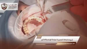 شروط الزمالة المصرية لجراحة الوجه والفكين