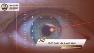 الزمالة المصرية لطب وجراحة العيون