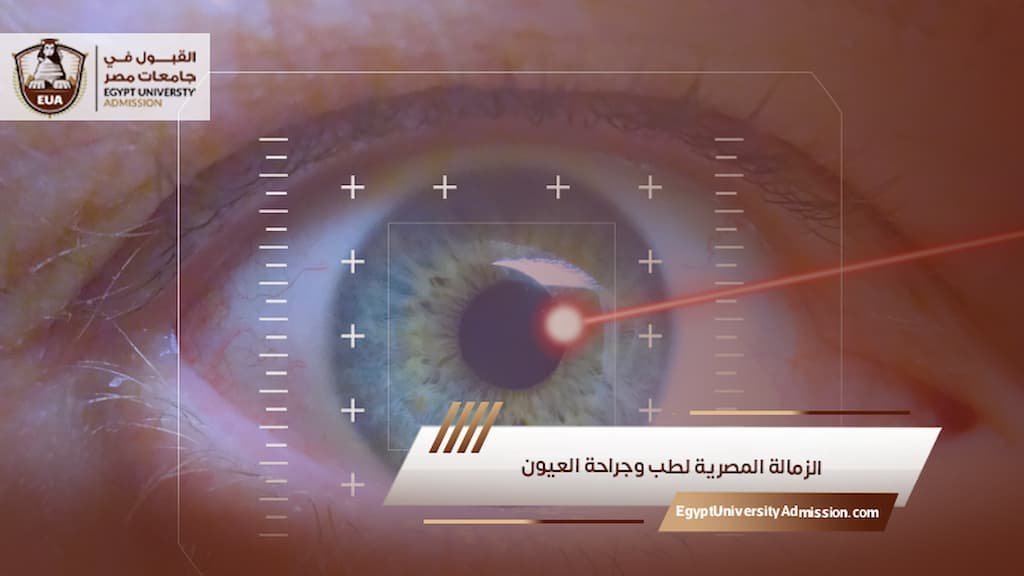 الزمالة المصرية لطب وجراحة العيون