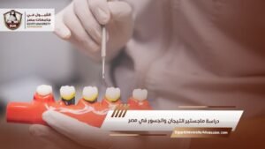 دراسة ماجستير التيجان والجسور في مصر