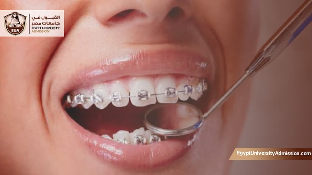 دراسة ماجستير تقويم الأسنان جامعة المنصورة