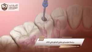 دراسة ماجستير علاج الجذور في مصر