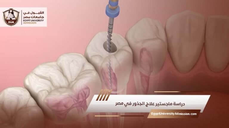 دراسة ماجستير علاج الجذور في مصر